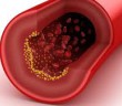 Angiogeneze, novotvorba cév pod vlivem výtažku z Maitake