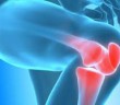 Dokáže Reishi snížit bolesti provázející revmatoidní artritidu?